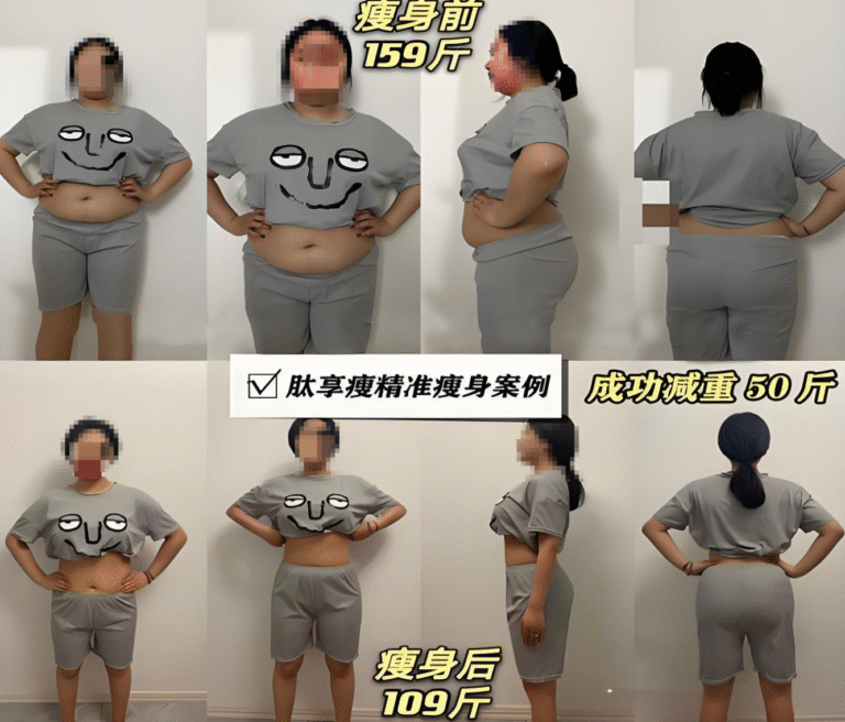 日本礼来替尓泊肽减肥减重案例